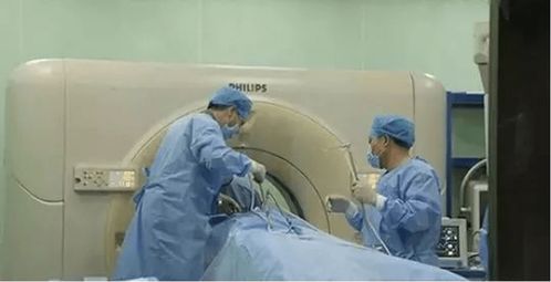 康博刀,最具性价比的治疗选择